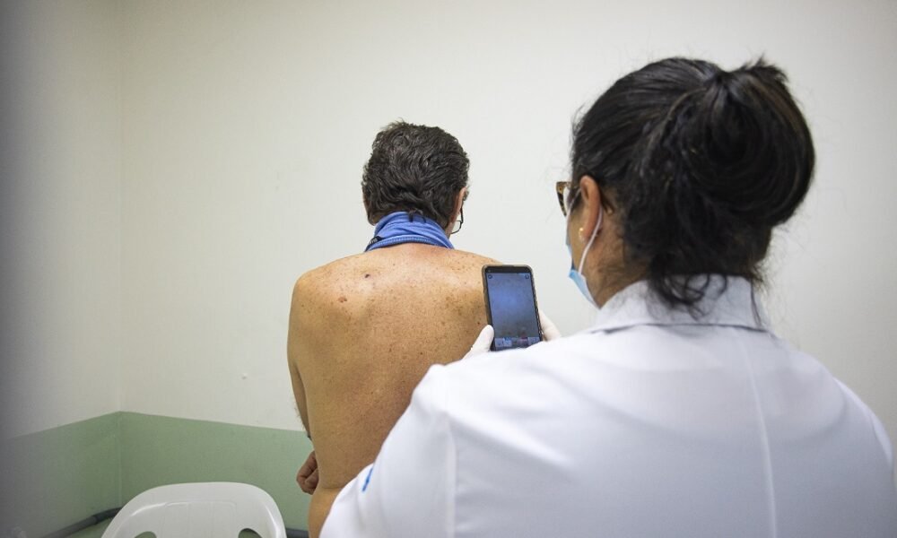 Prefeitura inicia mutirão de consultas de dermatologia na Estação Canoas